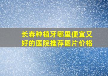 长春种植牙哪里便宜又好的医院推荐图片价格