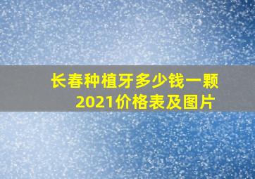 长春种植牙多少钱一颗2021价格表及图片