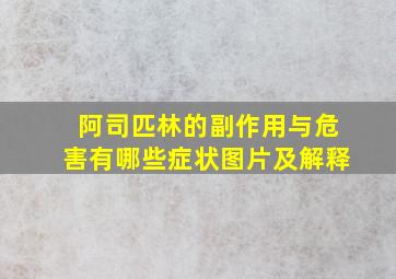 阿司匹林的副作用与危害有哪些症状图片及解释