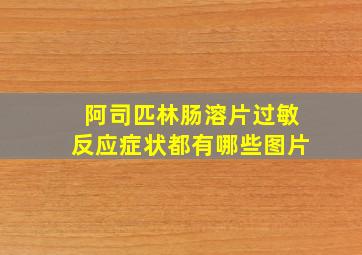 阿司匹林肠溶片过敏反应症状都有哪些图片