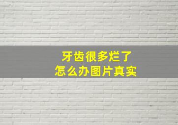 牙齿很多烂了怎么办图片真实